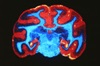 Brain scan image